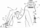 Fig. 01 - Iconic Representations Relating to Systems for Placing a Medical Device
