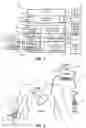 Fig. 02 - Iconic Representations Relating to Systems for Placing a Medical Device