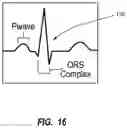 Fig. 18 - Iconic Representations Relating to Systems for Placing a Medical Device