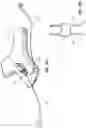 Fig. 23 - Iconic Representations Relating to Systems for Placing a Medical Device