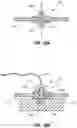 Fig. 29 - Iconic Representations Relating to Systems for Placing a Medical Device