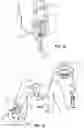 Fig. 33 - Iconic Representations Relating to Systems for Placing a Medical Device