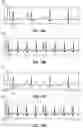 Fig. 45 - Iconic Representations Relating to Systems for Placing a Medical Device