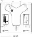 Fig. 48 - Iconic Representations Relating to Systems for Placing a Medical Device