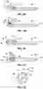 Fig. 05 - Catheter including contractible electroactive elements