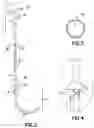 Fig. 03 - Ureteral stent