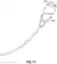 Fig. 08 - Ureteral stent