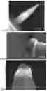 Fig. 07 - Microneedle for local delivery of therapeutic agent