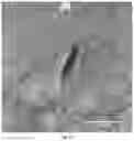 Fig. 11 - Microneedle for local delivery of therapeutic agent