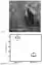 Fig. 12 - Microneedle for local delivery of therapeutic agent
