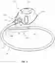 Fig. 02 - Distal valve for a catheter