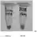 Fig. 08 - Separation Device, and Method of Use, to Remove PCR Inhibitors from Whole Blood and Serum Samples
