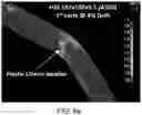 Fig. 24 - Ductile Fuse for Special Concentrically Braced Frames and Related Methods