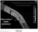 Fig. 25 - Ductile Fuse for Special Concentrically Braced Frames and Related Methods