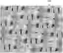 Fig. 01 - Absorbent structures with high absorbency and low basis weight