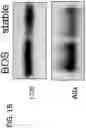 Fig. 03 - Systems and methods for diagnosing and treating chronic organ rejection