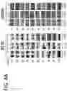 Fig. 12 - Systems and methods for diagnosing and treating chronic organ rejection