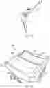Fig. 07 - Collapsible playard