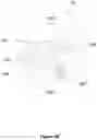 Fig. 07 - Systems and methods for visualizing ablated tissue