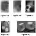 Fig. 09 - Systems and methods for visualizing ablated tissue