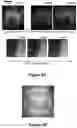 Fig. 10 - Systems and methods for visualizing ablated tissue