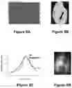 Fig. 13 - Systems and methods for visualizing ablated tissue