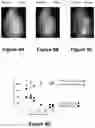 Fig. 14 - Systems and methods for visualizing ablated tissue