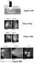 Fig. 15 - Systems and methods for visualizing ablated tissue
