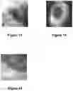 Fig. 17 - Systems and methods for visualizing ablated tissue