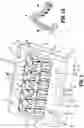 Fig. 02 - Ligation clip cartridge