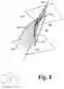 Fig. 09 - Interactive anterior-posterior axis determination