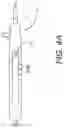 Fig. 05 - DEPLOYMENT DEVICE FOR PLACEMENT OF MULTIPLE INTRALUMINAL SURGICAL STAPLES