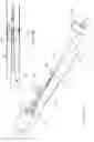 Fig. 32 - DEPLOYMENT DEVICE FOR PLACEMENT OF MULTIPLE INTRALUMINAL SURGICAL STAPLES