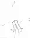 Fig. 47 - DEPLOYMENT DEVICE FOR PLACEMENT OF MULTIPLE INTRALUMINAL SURGICAL STAPLES