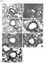 Fig. 02 - Sterically stabilized carrier for aerosol therapeutics, compositions and methods for treating the respiratory tract of a mammal