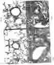 Fig. 07 - Sterically stabilized carrier for aerosol therapeutics, compositions and methods for treating the respiratory tract of a mammal