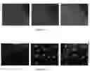 Fig. 22 - COMPOSITIONS AND METHODS FOR TREATING NEUROPSYCHIATRIC DISORDERS USING AN ENDOTHELIN-B RECEPTOR AGONIST