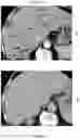 Fig. 06 - COMPOSITIONS AND METHODS OF USE OF INTERLEUKIN-10 IN COMBINATION WITH IMMUNE CHECK-POINT PATHWAY INHIBITORS