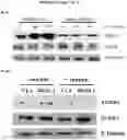 Fig. 07 - Cancer therapeutic methods utilizing OPCML fragment