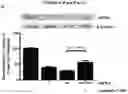 Fig. 22 - Cancer therapeutic methods utilizing OPCML fragment