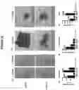 Fig. 47 - Cancer therapeutic methods utilizing OPCML fragment