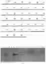 Fig. 02 - RECOMBINANT MUTANT (alpha)1-ANTITRYPSIN AND PREPARATION AND USES THEREOF