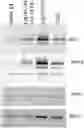 Fig. 01 - METHODS AND COMPOSITIONS FOR THE IMPROVEMENT OF LYSOSOMAL FUNCTION AND TREATMENT OF NEURODEGENERATIVE DISEASE