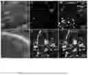 Fig. 04 - METHODS AND COMPOSITIONS FOR THE IMPROVEMENT OF LYSOSOMAL FUNCTION AND TREATMENT OF NEURODEGENERATIVE DISEASE