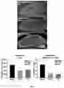 Fig. 06 - METHODS AND COMPOSITIONS FOR THE IMPROVEMENT OF LYSOSOMAL FUNCTION AND TREATMENT OF NEURODEGENERATIVE DISEASE