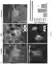 Fig. 07 - METHODS AND COMPOSITIONS FOR THE IMPROVEMENT OF LYSOSOMAL FUNCTION AND TREATMENT OF NEURODEGENERATIVE DISEASE