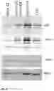 Fig. 09 - METHODS AND COMPOSITIONS FOR THE IMPROVEMENT OF LYSOSOMAL FUNCTION AND TREATMENT OF NEURODEGENERATIVE DISEASE