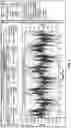 Fig. 07 - Method and apparatus for high frequency common mode (L-G) phenomena and associated affect on ESP and mechnical run life