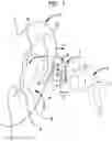 Fig. 02 - Reconfigurable intra-auricular support