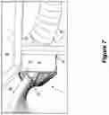 Fig. 07 - Seed entrainment unit